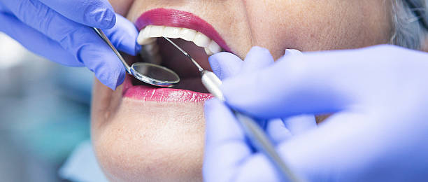 Best Emergency Root Canal Treatment in Moorhead, MS